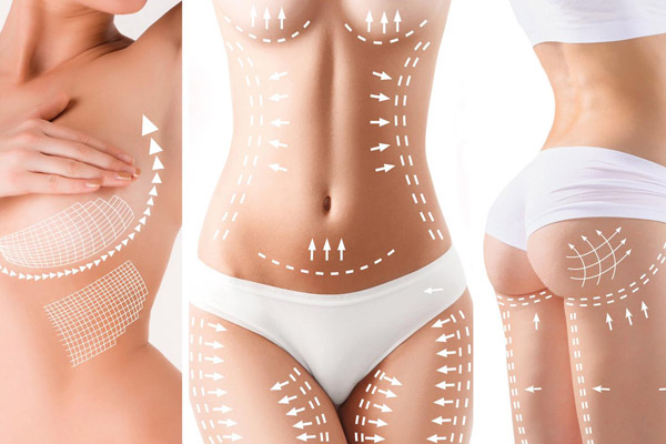 annelik-estetigi-MOMM-MAKEOVER-600x400